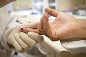 Campanha incentiva testagem para diagnóstico precoce de hepatites no Brasil
