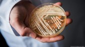  Candida auris, superfungo que preocupa Europa, EUA e Brasil 