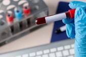 Piauí reduz mortes por hepatite B em 55% e avança no enfrentamento da hepatite C