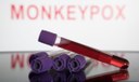Brasil faz 8.850 testes de varíola dos macacos