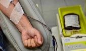 Brasil reduz mortalidade por hepatites, mostra boletim