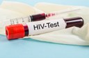 Brasil tem aumento de mortes de pessoas com HIV por tuberculose Brasil tem aumento de mortes de pessoas com HIV por tuberculose