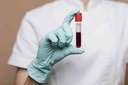 Dia Mundial da Hemofilia: especialista esclarece dúvidas