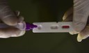 Hospitalizações por covid-19 aumentam em todos os estados