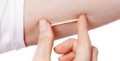 Implante contraceptivo hormonal será oferecido pelo SUS