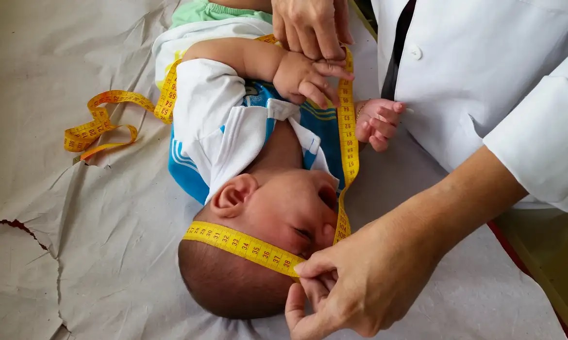 INSS pagará indenização de R$ 60 mil a crianças vítimas de zika