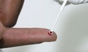 Medicamento injetável é nova opção de prevenção contra HIV