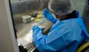 Novo remédio para hepatite C poderá baixar custo