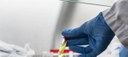 ONU alerta para risco elevado de novas doenças e epidemias