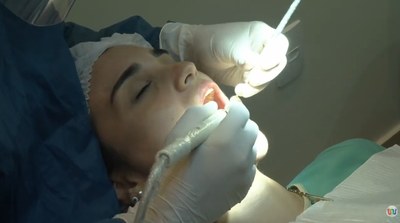 Periodontite preocupa especialistas e exige atenção redobrada com a saúde bucal