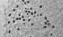 Pesquisa indica risco de monkeypox agravar infecção por HIV