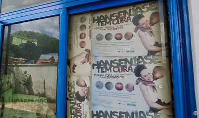 Picos mantém cenário controlado da hanseníase e amplia estratégia de diagnóstico