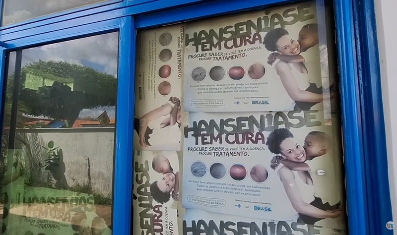 Picos mantém cenário controlado da hanseníase e amplia estratégia de diagnóstico