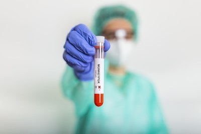 Saúde negocia compra de 25 mil doses de vacina contra mpox