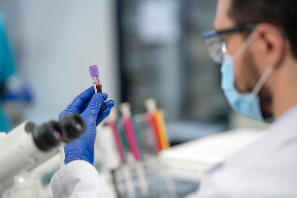 SUS vai substituir papanicolau por exame mais sensível ainda este ano