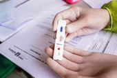Teresina registra queda na positividade de testes Covid