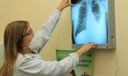 Tosse, febre e suor noturno: como identificar a tuberculose
