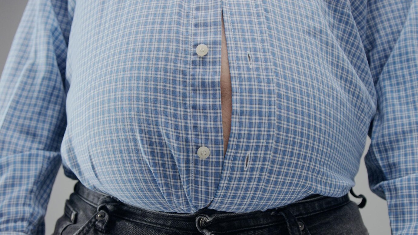 Um a cada três brasileiros vive com obesidade, mostra relatório global