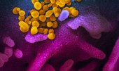 Covid-19: estudo aponta aumento de bactérias resistentes em UTIs